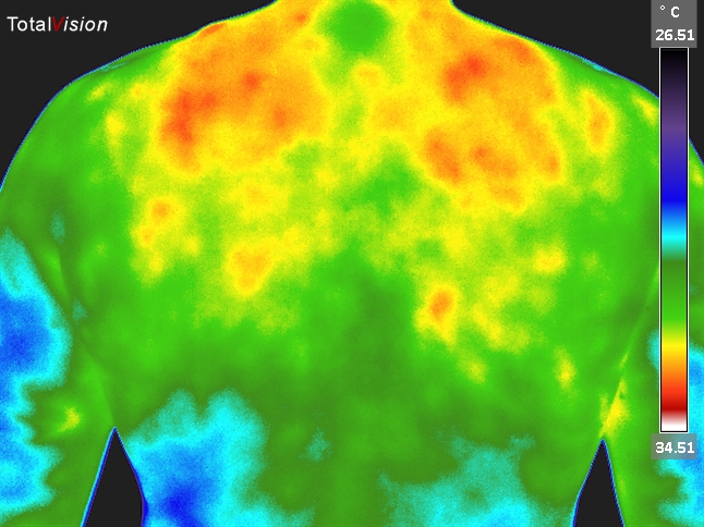 Thermal image of a back.
